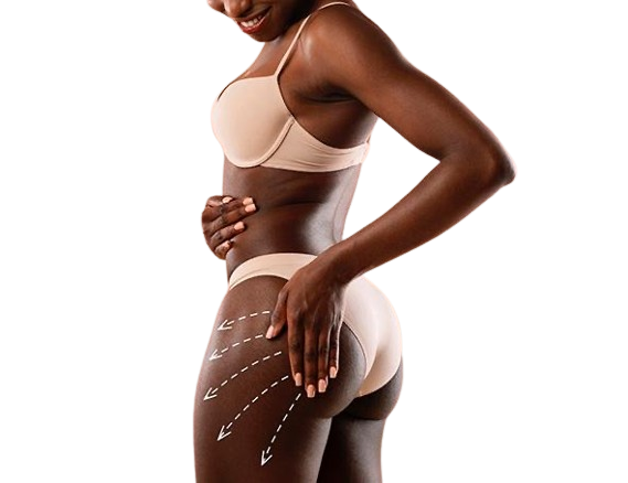 Advanced Dermal Filler Buttock Lift Training Course